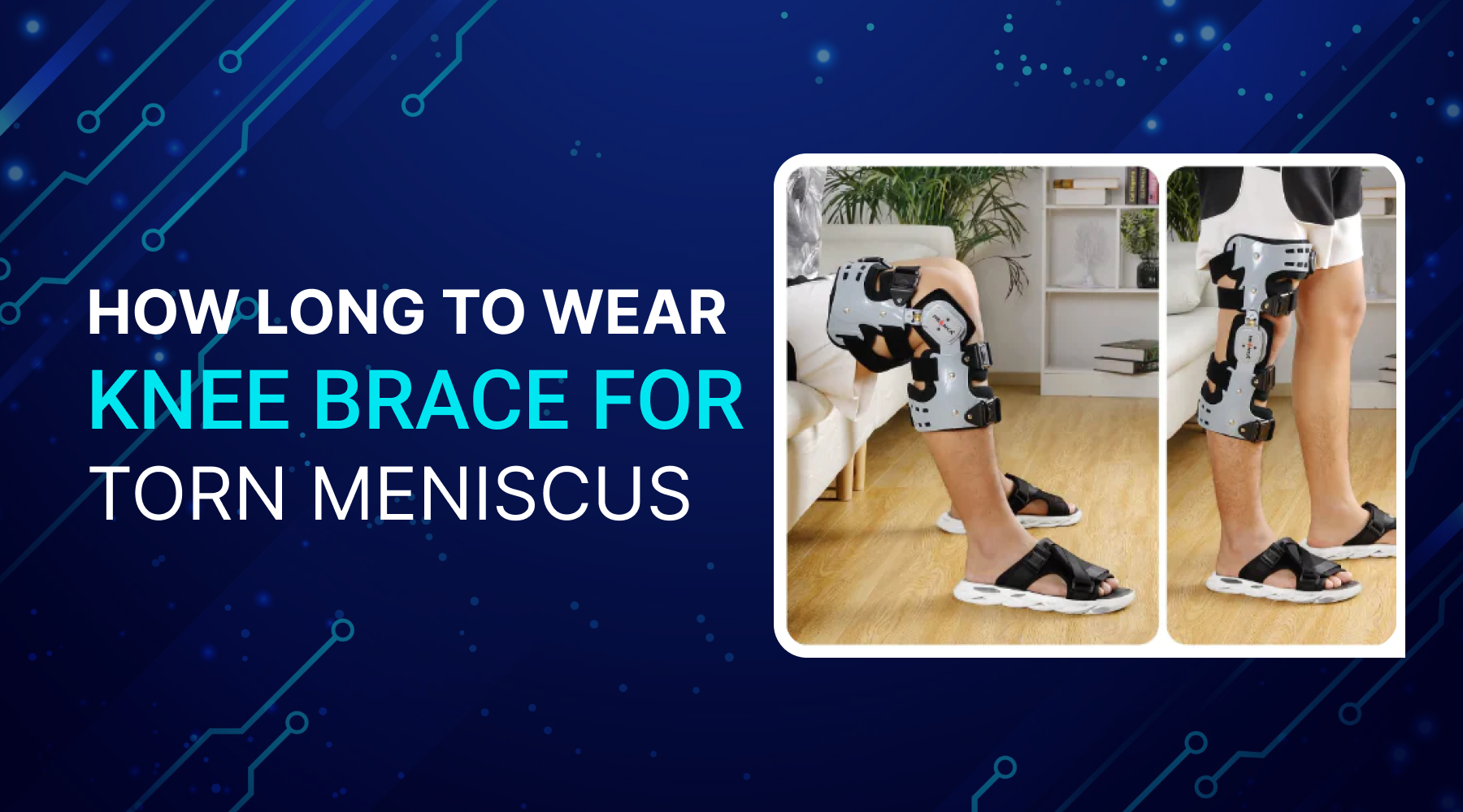 How Long to Wear Knee Brace for Torn Meniscus